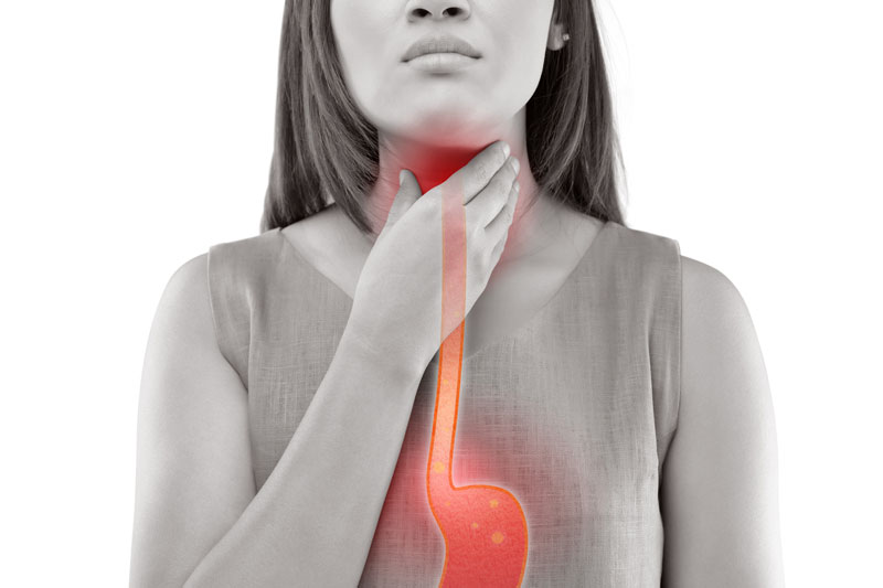 Why do you have Acid Reflux